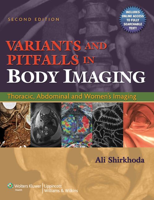 Variants and Pitfalls in Body Imaging: Thoracic, Abdominal and Womens Imaging