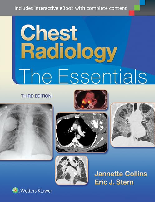 Chest Radiology The Essentials 3Ed (Hb 2015)