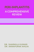 PeriImplantitis  A Comprehensive Review.