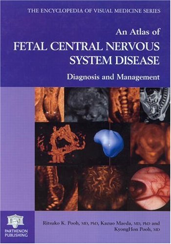 ATLAS FETAL CENTR NERV SYST: Diagnosis and Management (Encyclopedia of Visual Medicine Series, 64)