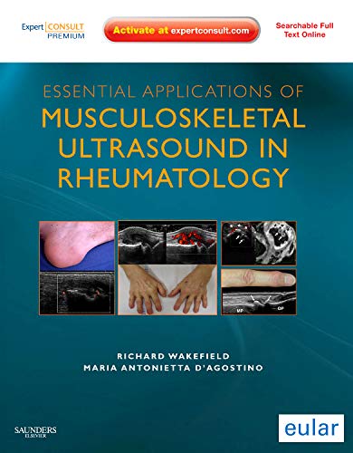 Essential Applications of Musculoskeletal Ultrasound in Rheumatology: Expert Consult Premium Edition: Enhanced Online Features a