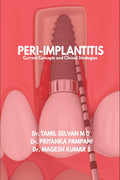 PeriImplantitis: Current Concepts and Clinical Strategies