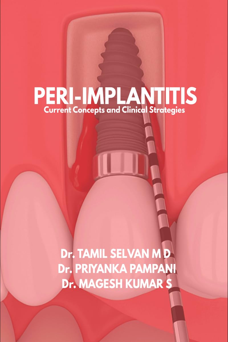 PeriImplantitis: Current Concepts and Clinical Strategies