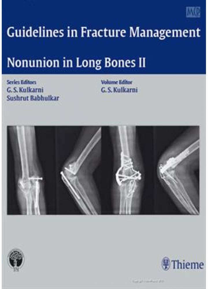 Guidelines in Fracture ManagementNonunion in Long Bones II