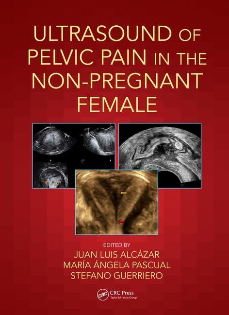 Ultrasound of Pelvic Pain in the NonPregnant Patient