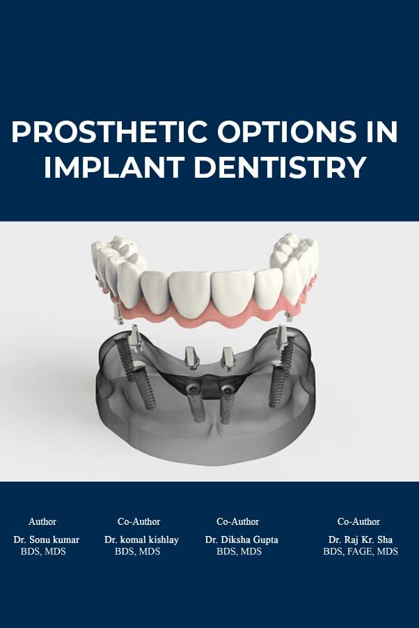 Prosthetic Ptions In Implant Entistry