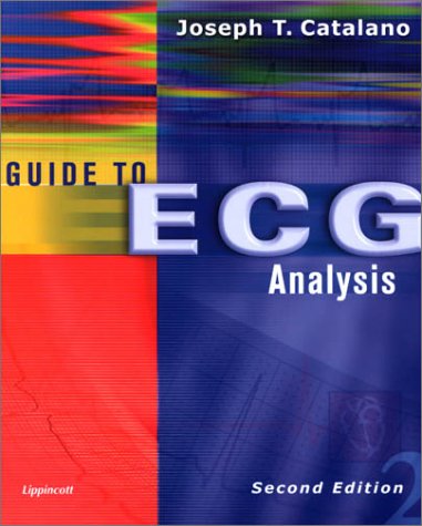 Guide to Ecg Analysis