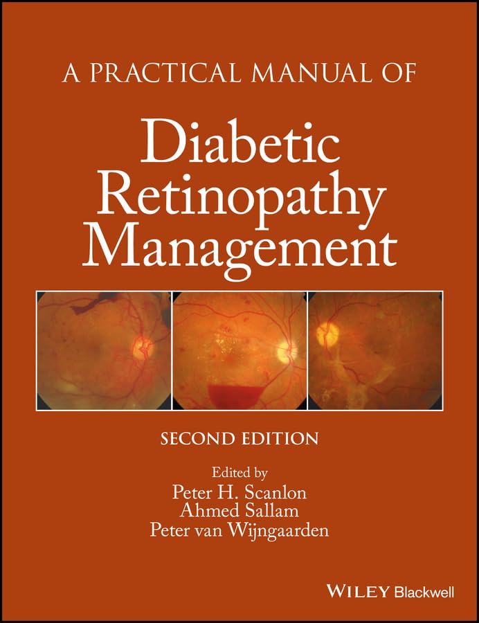 A PRACTICAL MANUAL OF DIABETIC RETINOPATHY MANAGEMENT 2ED (Practical Manual of Series)