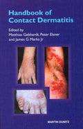 Handbook Of Contact Dermatitis