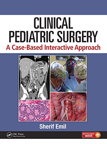 Clinical Pediatric Surgery A Case Based Interactive Approach With Access Code (Hb 2020)