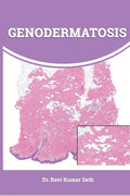 Genodermatosis