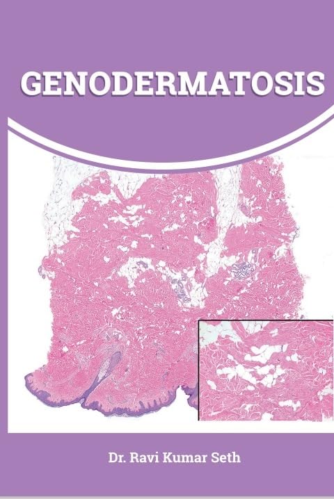 Genodermatosis