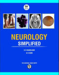 NEUROLOGY SIMPLIFIED 4ED (PB 2026)