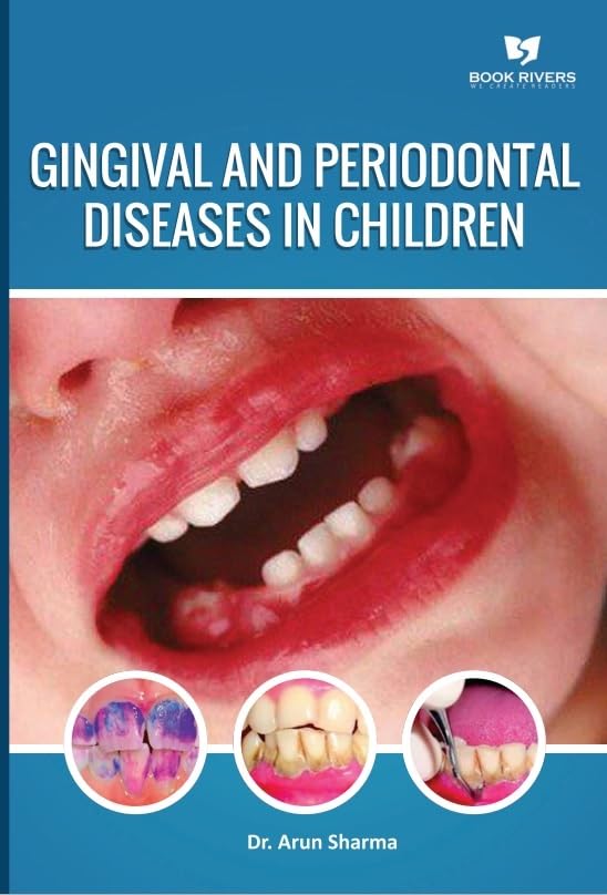 Gingival And Periodontal Diseases In Children