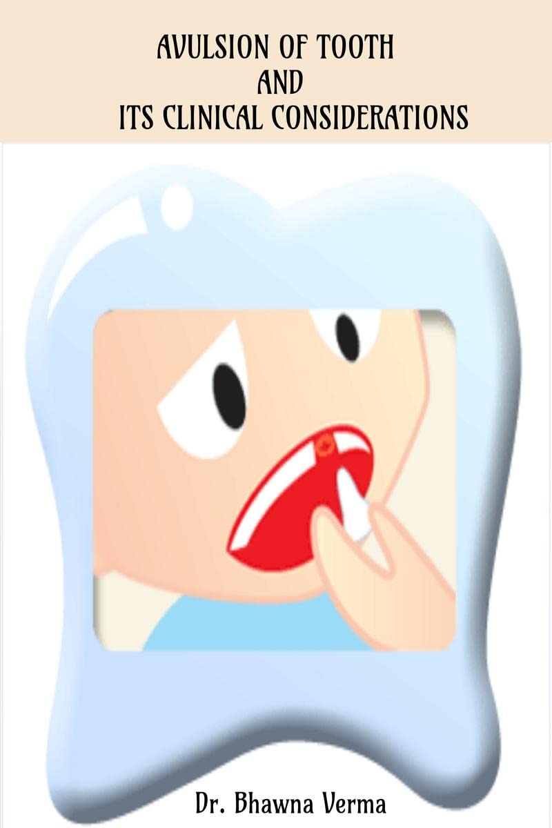 Avulsion Of Tooth And Its Clinical Considerations : Dental Traumatic Injuries