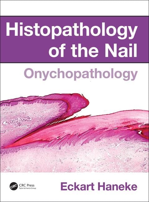 Histopathology Of The Nail Onychopathology (Hb 2017)