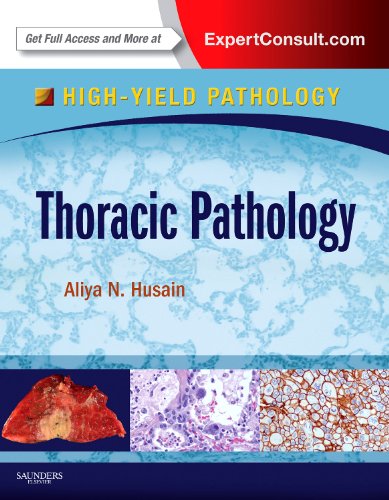 Thoracic Pathology: A Volume in the High Yield Pathology Series (Expert Consult  Online and Print)
