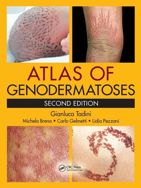 Atlas Of Genodermatoses 2Ed