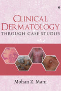 Clinical Dermatology Through Case Studies