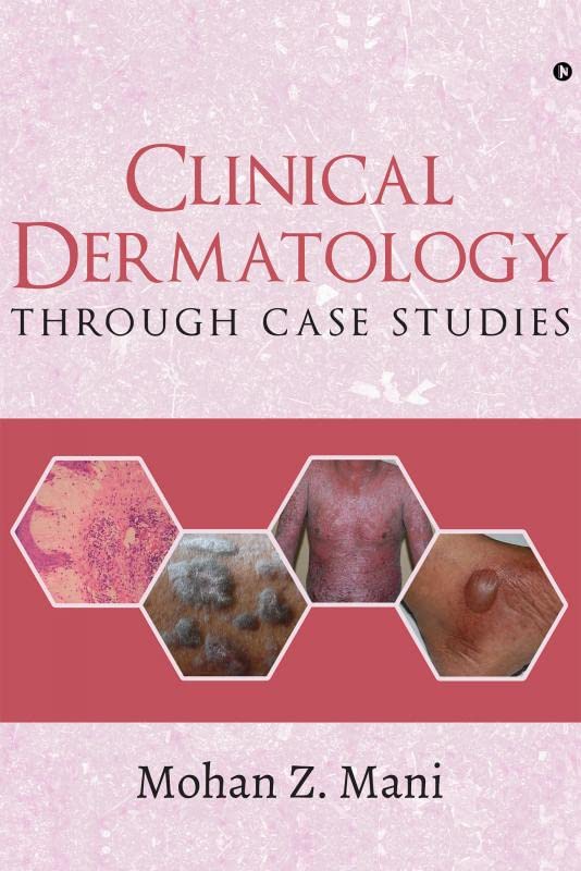Clinical Dermatology Through Case Studies