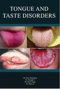 TONGUE AND TASTE DISORDERS