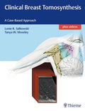 Clinical Breast Tomosynthesis 1st Edition