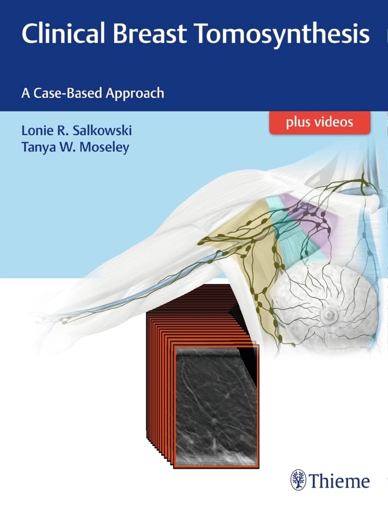 Clinical Breast Tomosynthesis 1st Edition