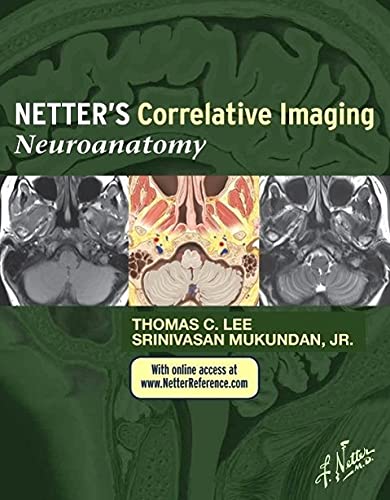 Netters Correlative Imaging Neuroanatomy (Hb 2014): with NetterReference.com Access (Netter Clinical Science)