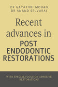 Recent advances in post endodontic restorations