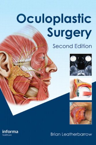 Oculoplastic Surgery, Second Edition