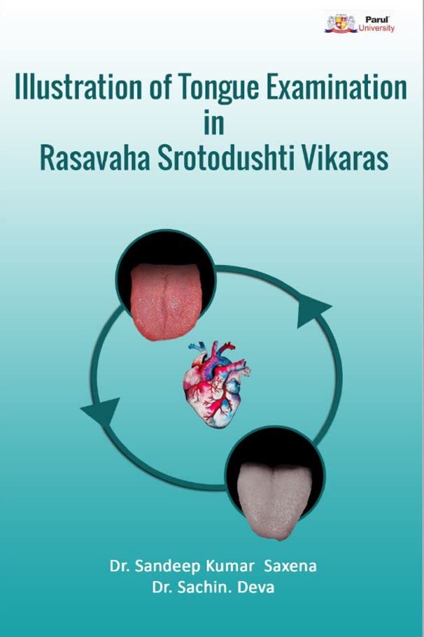 Illustration Of Tongue Examination In Rasavaha Srotodushti Vikaras