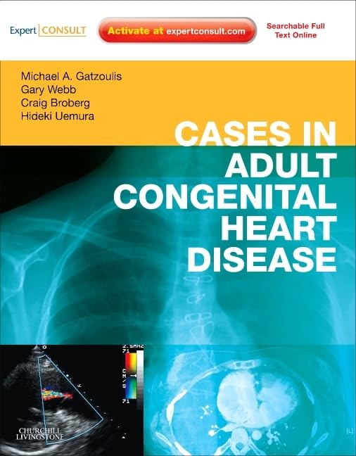 Cases in Adult Congenital Heart Disease  Expert Consult: Online and Print: Atlas