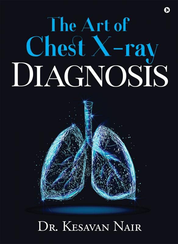 The Art Of Chest XRay Diagnosis