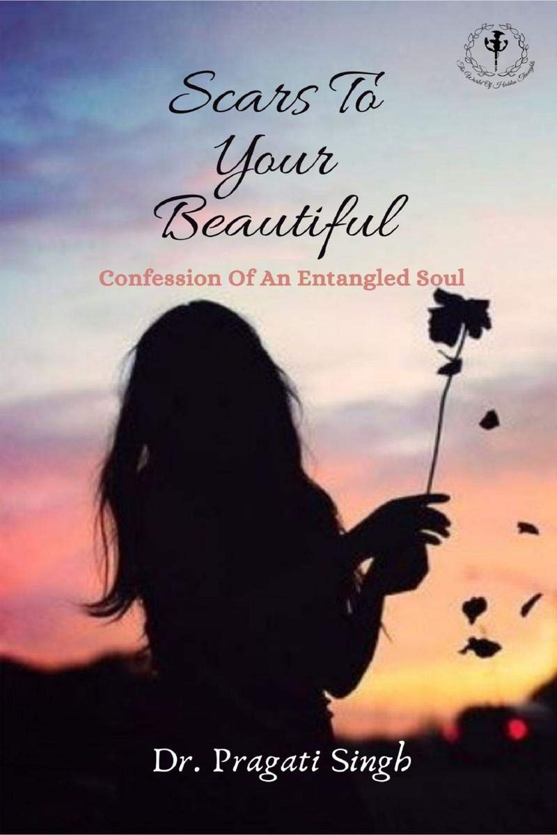 Scars To Your Beautiful
