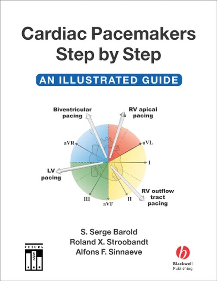 Cardiac Pacemakers StepbyStep: An Illustrated Guide