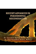RECENT ADVANCES IN PERIODONTAL REGENERATION
