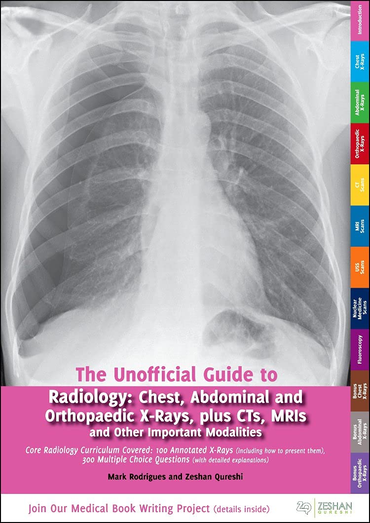 The Unofficial Guide To Radiology (Pb 2014) Spl Price: Chest, Abdominal and Orthopaedic X Rays, Plus CTs, MRIs and Other Importa
