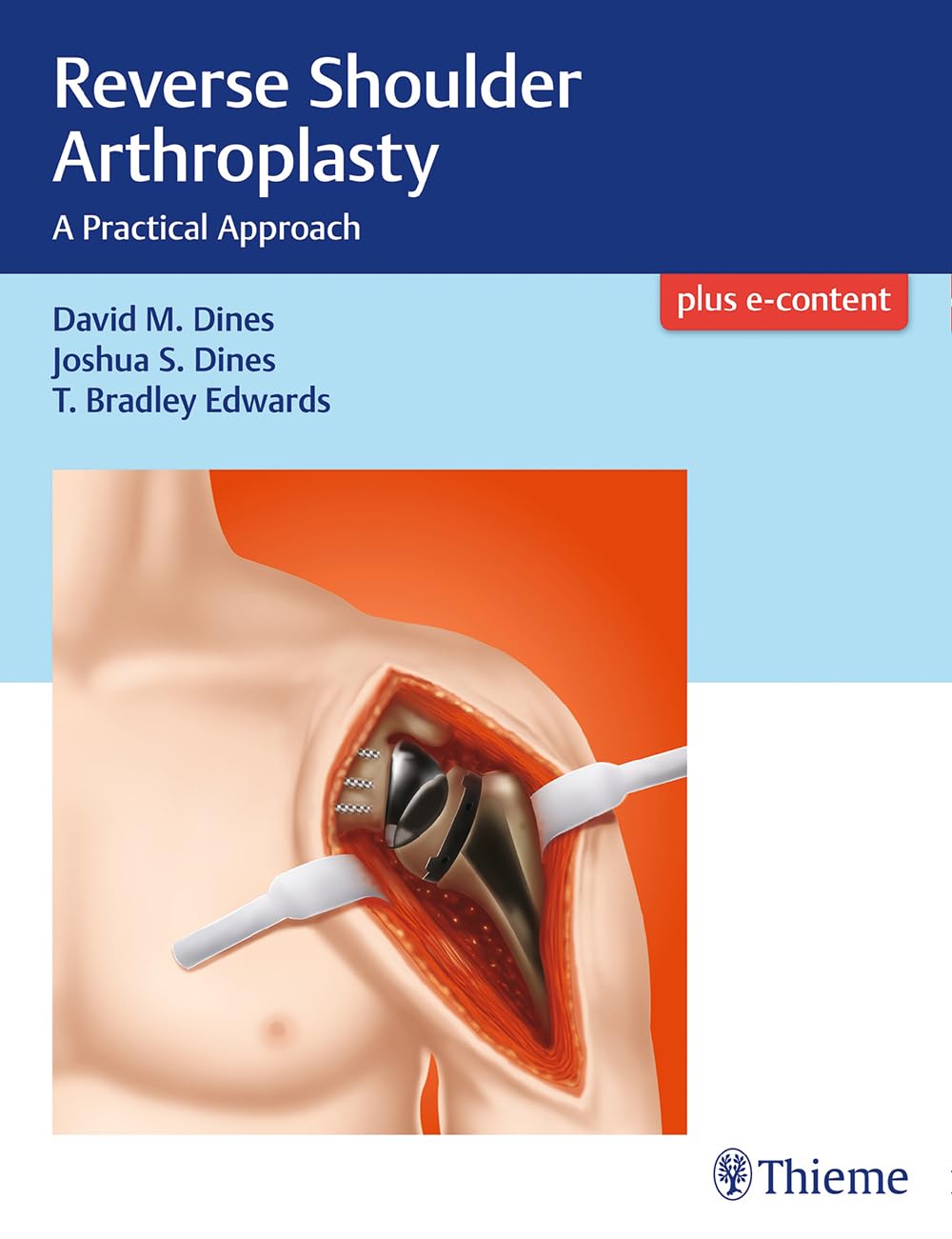 REVERSE SHOULDER ARTHROPLASTY A PRACTICAL APPROACH (HB 2018)