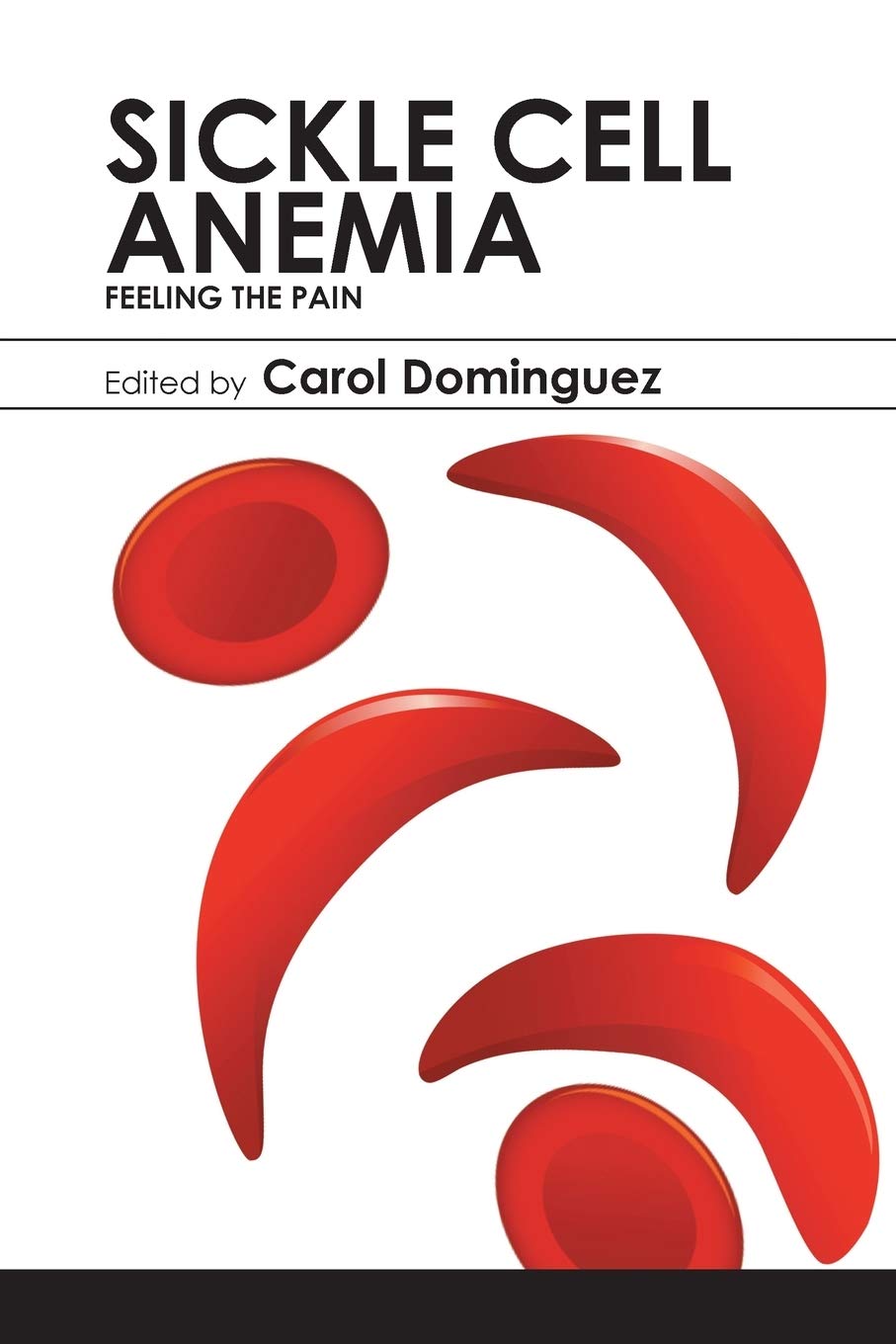 Sickle Cell Anemia: Feeling the Pain