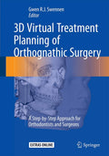 3D Virtual Treatment Planning of Orthognathic Surgery: A StepbyStep Approach for Orthodontists and Surgeons