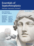 Essentials of Septorhinoplasty: Philosophy, Approaches, Techniques