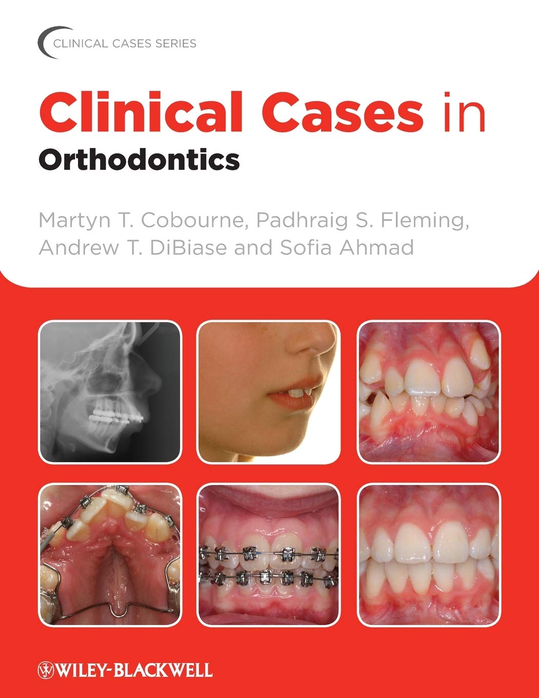 Clinical Cases in Orthodontics