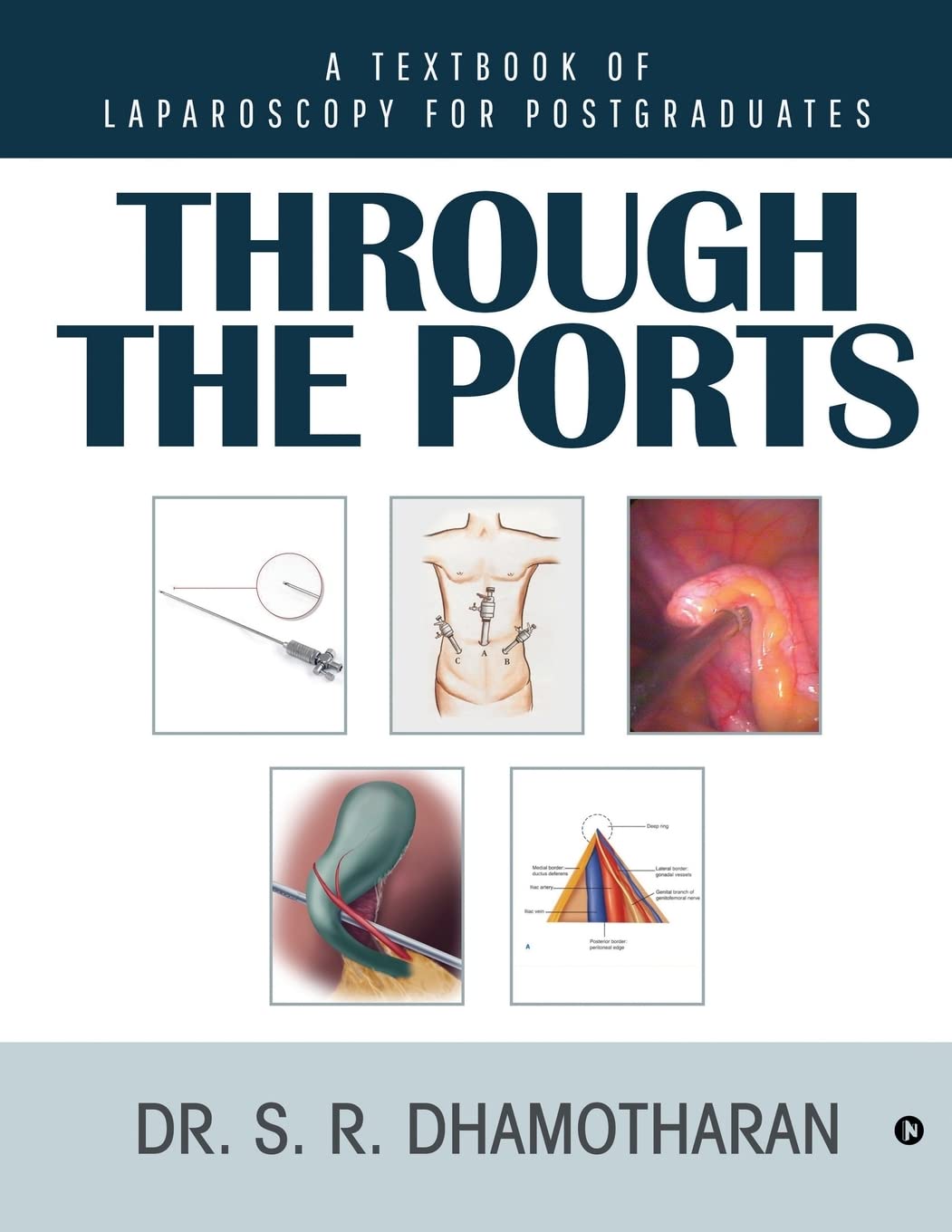 Through The Ports : A Textbook Of Laparoscopy For Postgraduates
