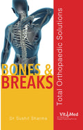 Bones and Breaks (English, Paperback, Sharma