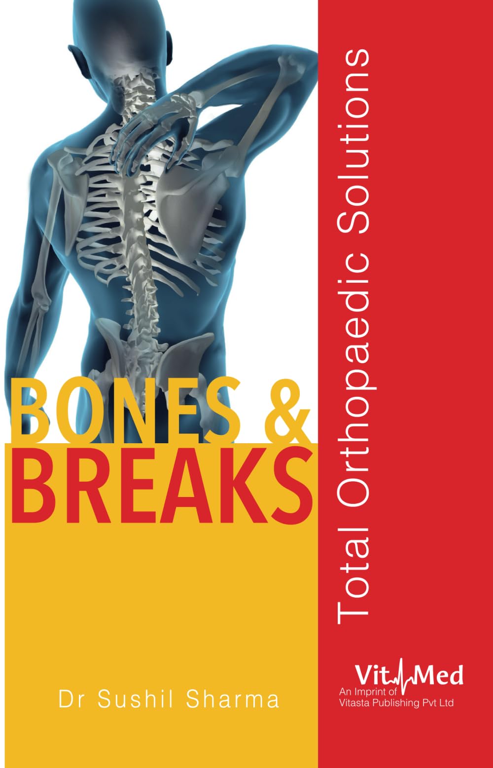 Bones and Breaks (English, Paperback, Sharma