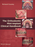 The Orthodontic Miniimplant Clinical Handbook
