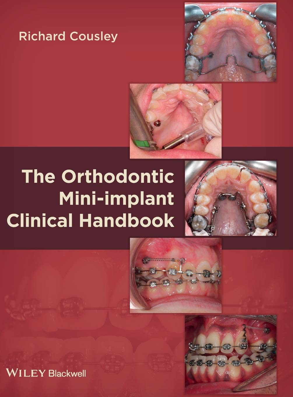 The Orthodontic Miniimplant Clinical Handbook