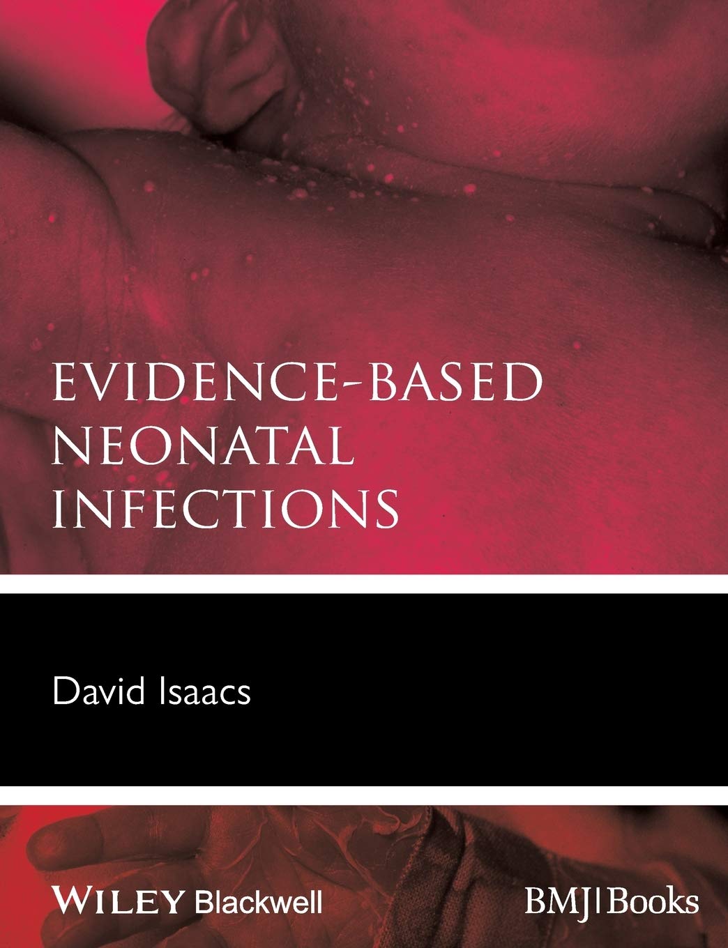 EvidenceBased Neonatal Infections
