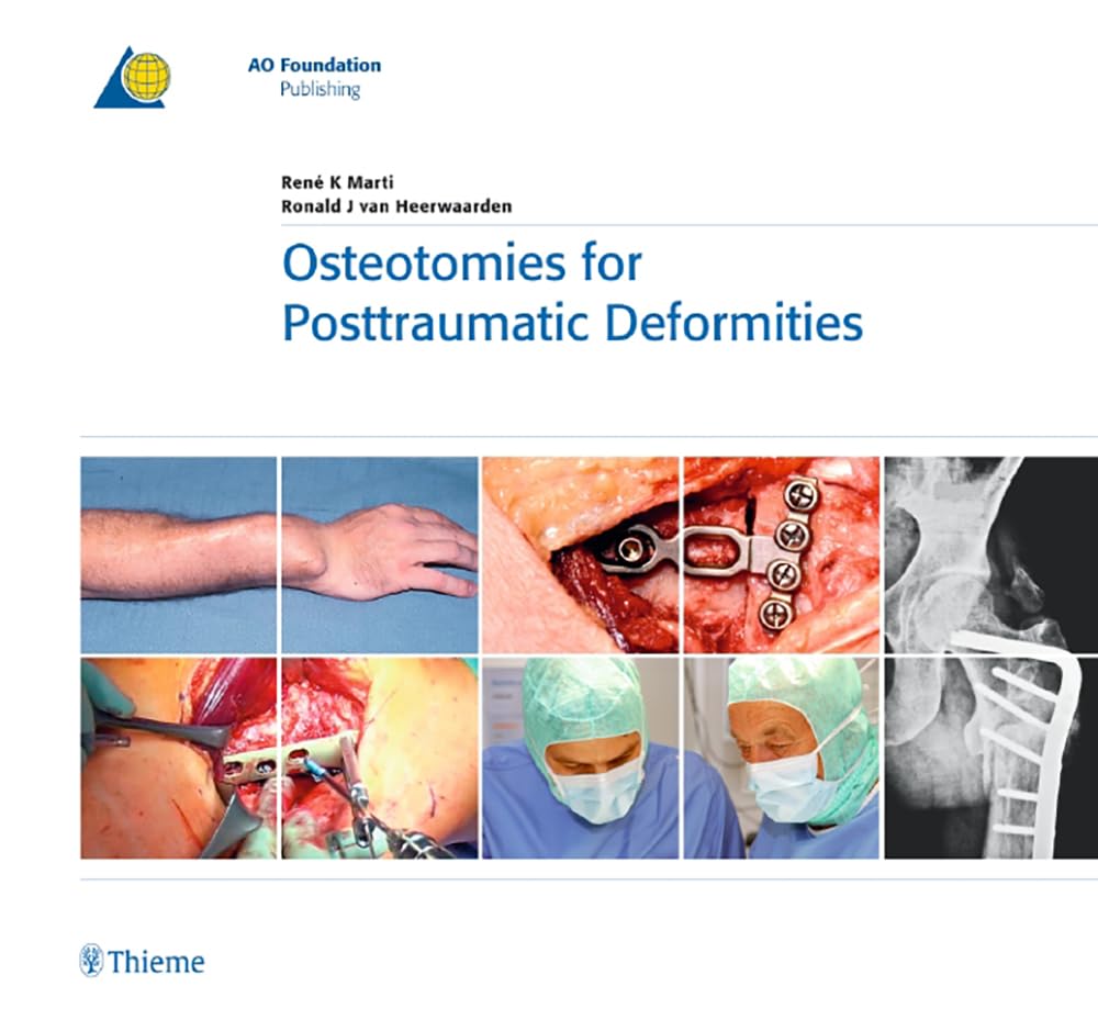 Osteotomies for Posttraumatic Deformities (AOPublishing)