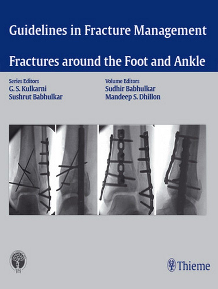 Guidelines in Fracture Management Fractures around the Foot and Ankle